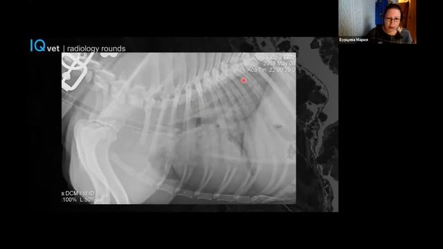 RR Case №5: Кровоизлияние в легких после отравления родентицидами (крысиным ядом) смотреть онлайн