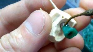 мк на имплантах винтовая фиксация 1часть каркасы