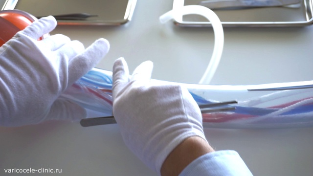 Операция при варикоцеле яичка у мужчин