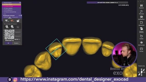 Exocad Stream / New Asiga / Apollo Teeth Library / Теперь все техники Стримят :) /Отвечаю на Вопрос