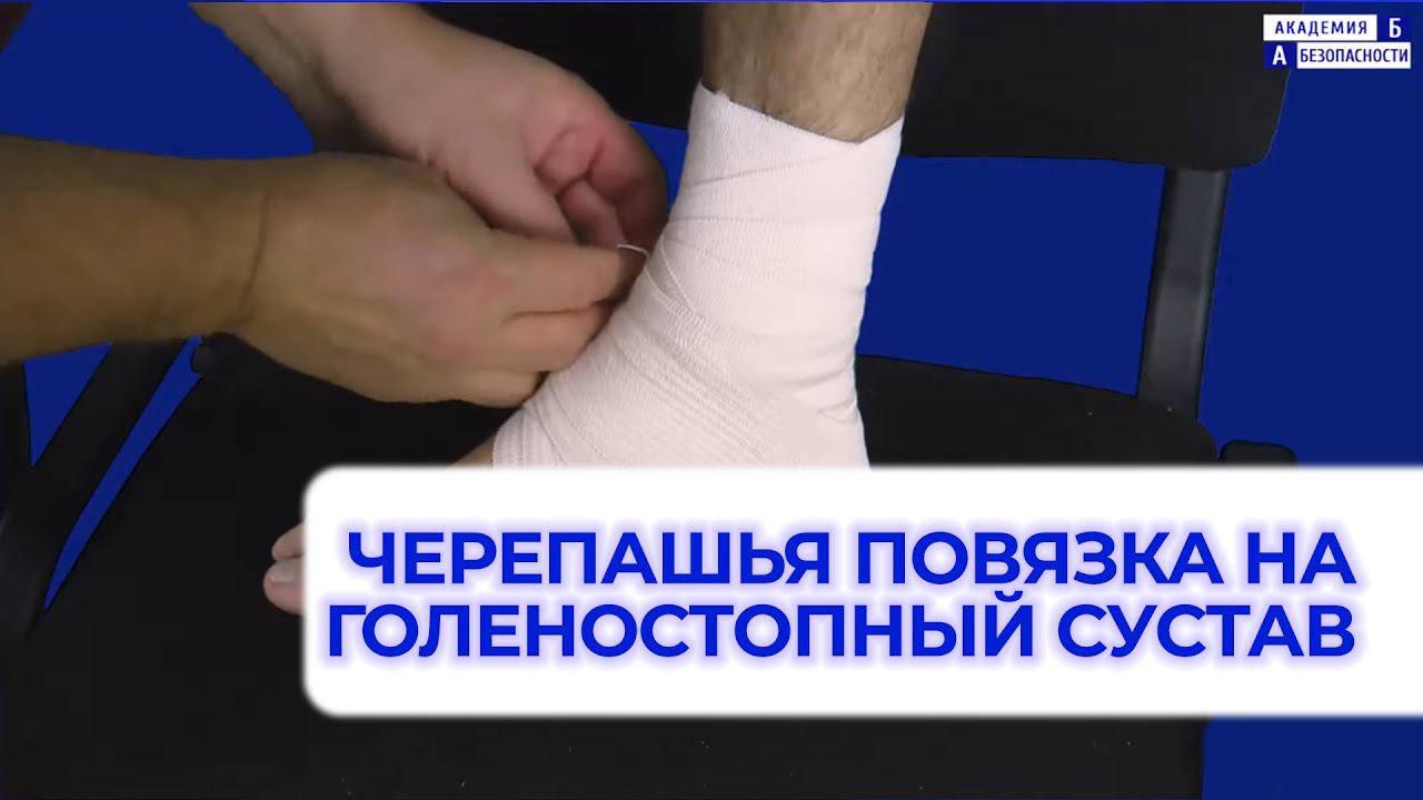 Наложение черепашьей сходящейся повязки на голеностопный сустав смотреть онлайн