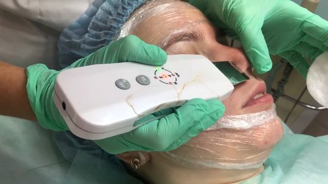 Чистка лица ультразвуком . смотреть онлайн