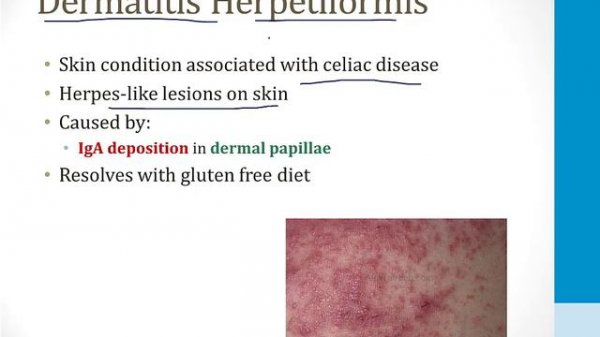 Gastroenterology - 3. Clinical Gastroenterology - 9.Malabsorption atf