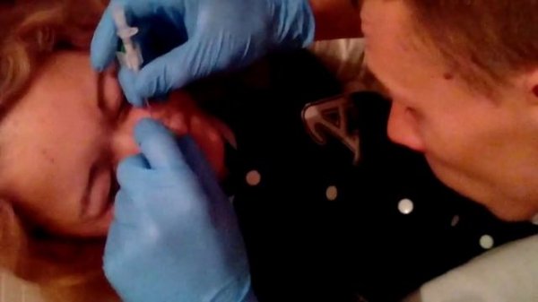 Прокол носа