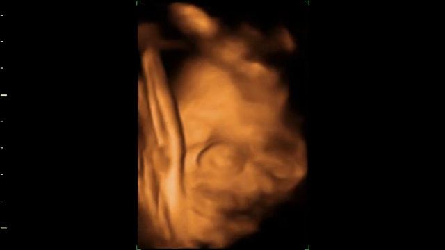 Мы зеваем (27 недель) смотреть онлайн