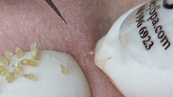 Relax Every Day With Sac Dep Spa #0359