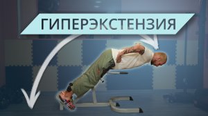 Гиперэкстензия