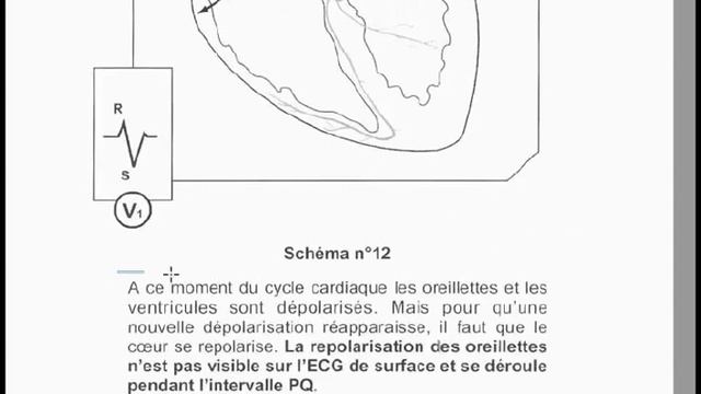 ECG ALGERIENS BEDARIJA 6.2 Principes d'interprétation ECG 2/4 смотреть онлайн