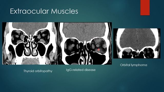 How To Read Imaging Of The Orbits: A Pathology Based Approach