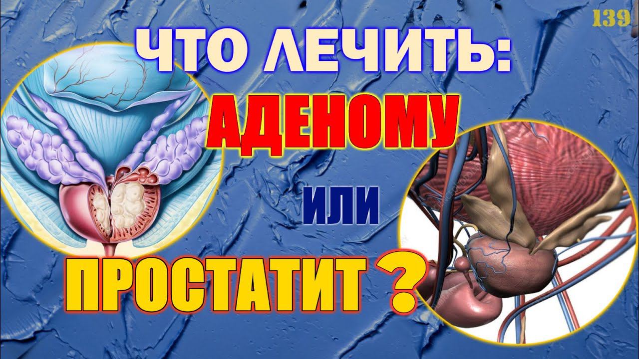 Что лечить - аденому или простатит? смотреть онлайн