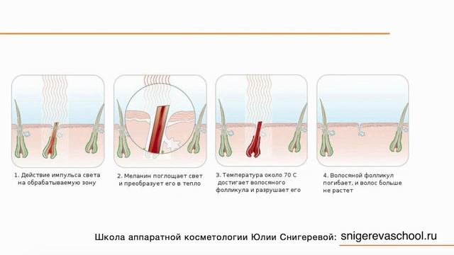 Урок Фотоэпиляция смотреть онлайн