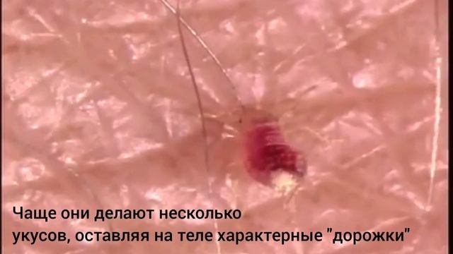 Всего одна минута | Удалось заснять укус клопа | Компания ДезКом | dez-com.ru смотреть онлайн