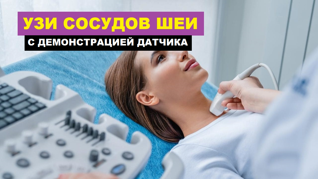 УЗИ сосудов ШЕИ. Порядок выполнения. Демонстрация установки ДАТЧИКА. смотреть онлайн
