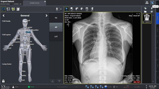 VXvue Quick Guide 02. X-ray Exposure смотреть онлайн
