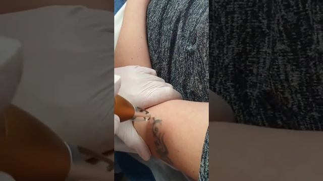 Как удалить татуировку? How remove tattoo?! смотреть онлайн