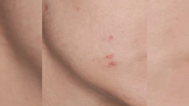 Маскируем ЛЮБЫЕ недостатки при помощи минерального консилера смотреть онлайн