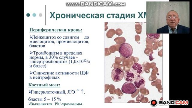 Миелопролиферативные заболевания Диагностика и лечение Часть 1 смотреть онлайн