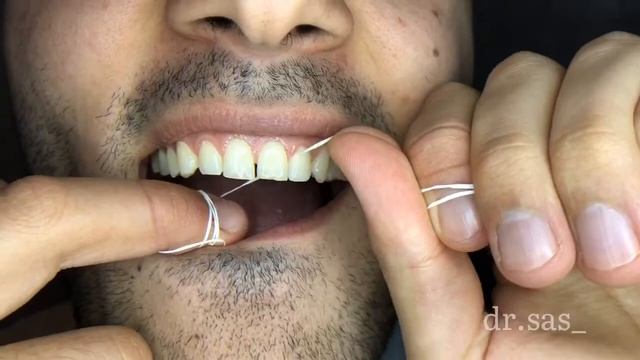 Как правильно пользоваться зубной нитью(флоссом)!