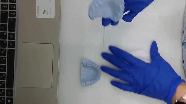 методика проведения конструктивного прикуса при трансверзальной дизокклюзии смотреть онлайн