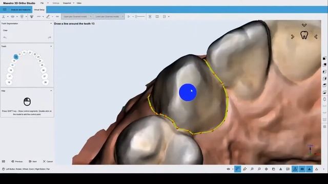 Maestro 3D & Medit: From I500 Scans To Clear Aligners In Ortho Studio