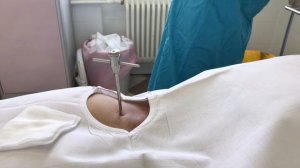 Трепанобиопсия костного мозга г.Москва