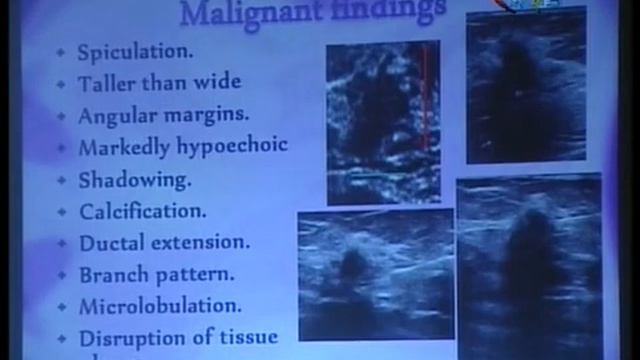 Lecture 16 Breast radiology Dr Nglaa Abdelrazek смотреть онлайн