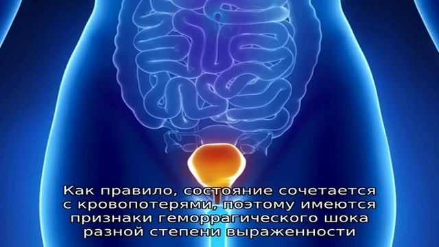 Почему болит в области мочевого пузыря смотреть онлайн