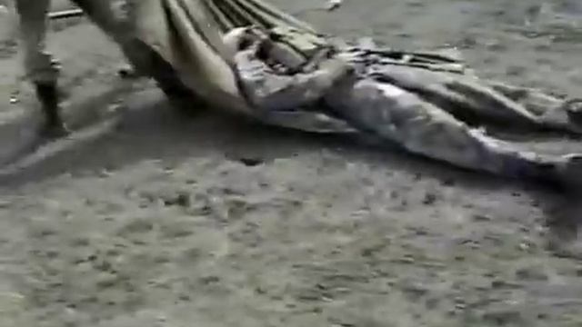 Хирургия повреждений -- политравма  -  Multiple Injuries