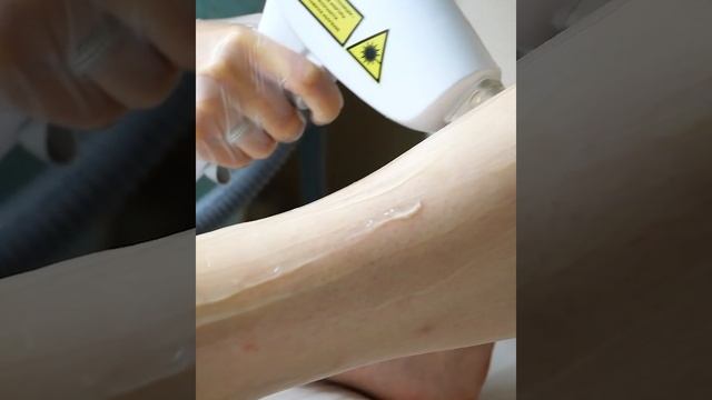 ElArm Студия лазерной эпиляции смотреть онлайн