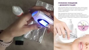 ОБЗОР  ультразвуковой чистки лица ReadySkin ZX7080 с Wildberries |ПОДРОБНАЯ ИНСТРУКЦИЯ|УхОд за КоЖе