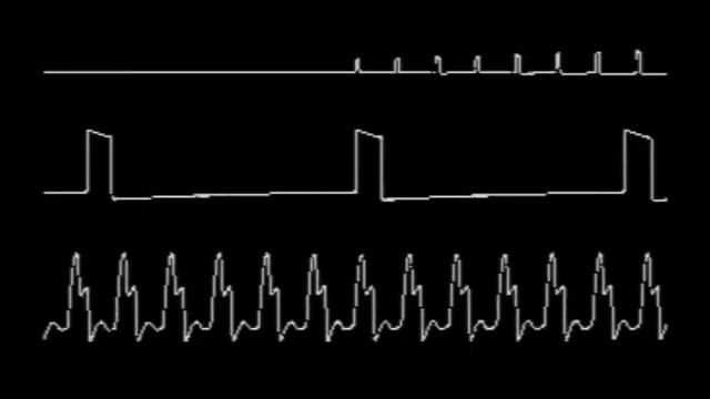 Oscilloscope view on C64 смотреть онлайн
