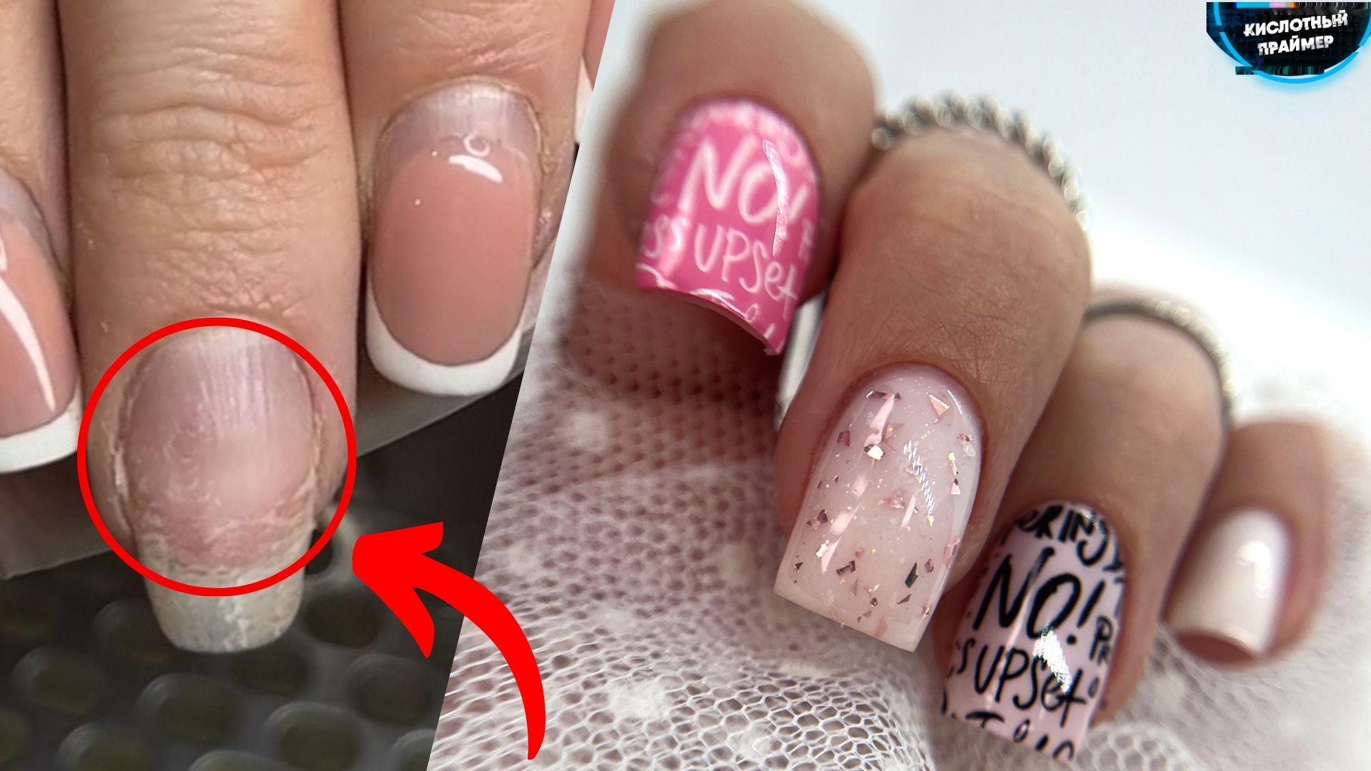 ?НЕ ОЖИДАЛА! СЛЕТЕЛ НОГОТЬ и ОТСЛОЙКИ на ногтях! МОДЕЛИРОВАНИЕ ногтей ГЕЛЕМ! Форма ЧЕТКИЙ КВАДРАТ смотреть онлайн