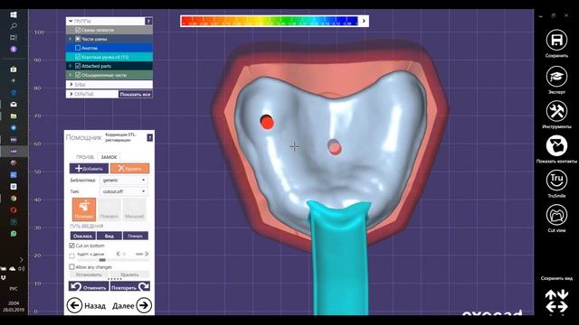 Exocad Индивидуальная ложка смотреть онлайн