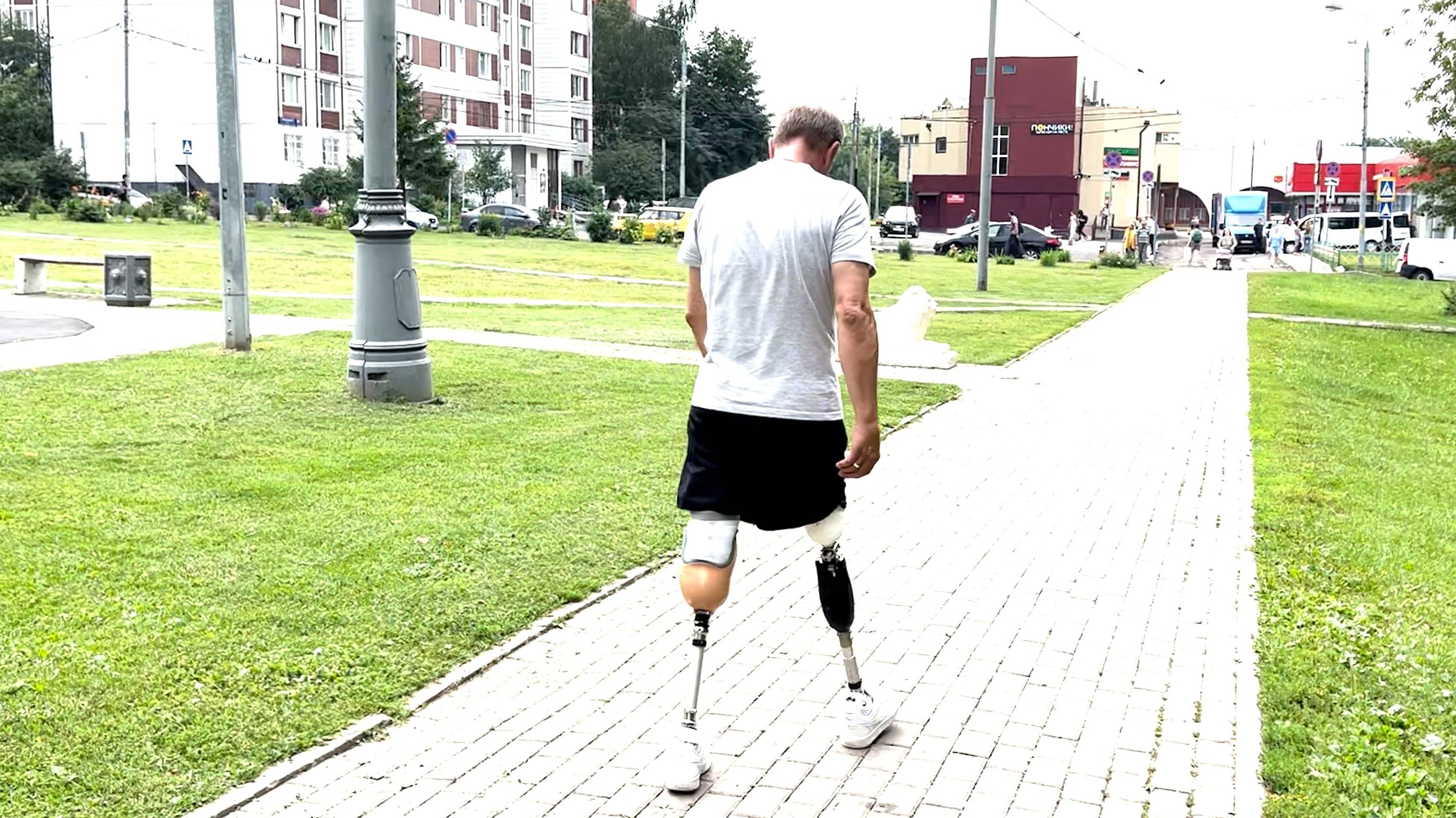 Мой первый протез бедра с микропроцессором смотреть онлайн