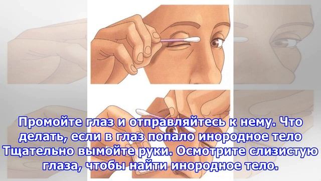 Что делать, если что-то попало в глаз смотреть онлайн