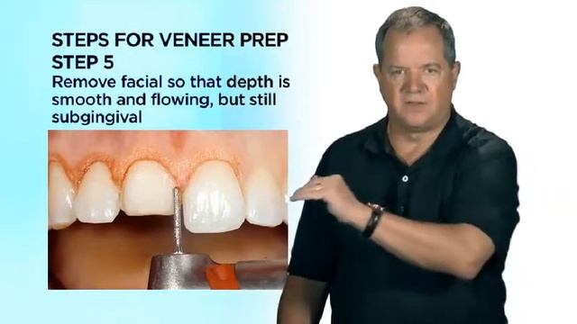 lecture 1 Anterior Veneer Preparation, Philosophy and Steps смотреть онлайн