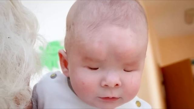 Мать отказалась от ребенка, который родился без глаз. История до слёз! смотреть онлайн