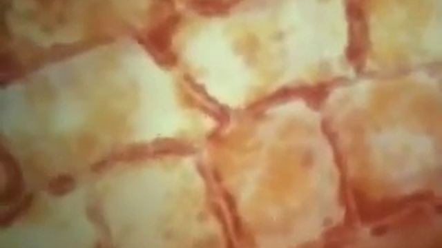 Движение цитоплазмы в клетках элодеи flv смотреть онлайн