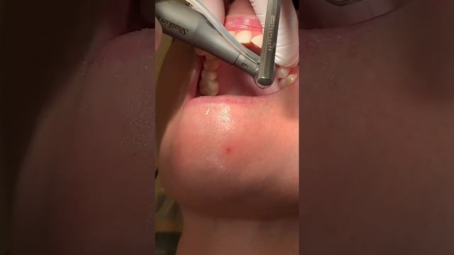 Implant done смотреть онлайн