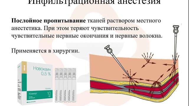 3.3. Виды анестезии смотреть онлайн