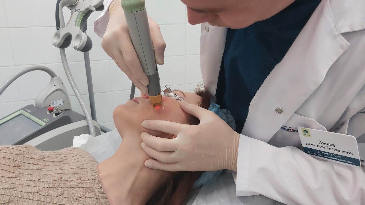 Лазерное омоложение лица: лечение купероза, пигментации, диффузной красноты в Центре Флебологии смотреть онлайн