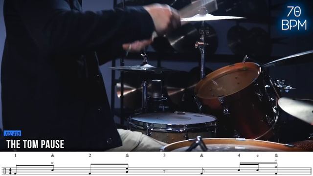 20 MUST KNOW Drum Fills For Beginner Drummers | Drum Beats Online