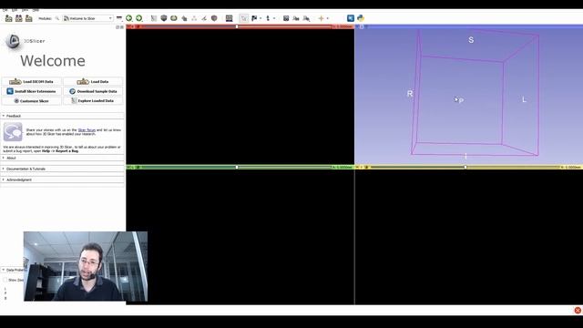 Como instalar y usar 3D Slicer 2021 - Curso de 3D Slicer parte 1 смотреть онлайн