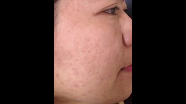 Сохранение здоровья. смотреть онлайн