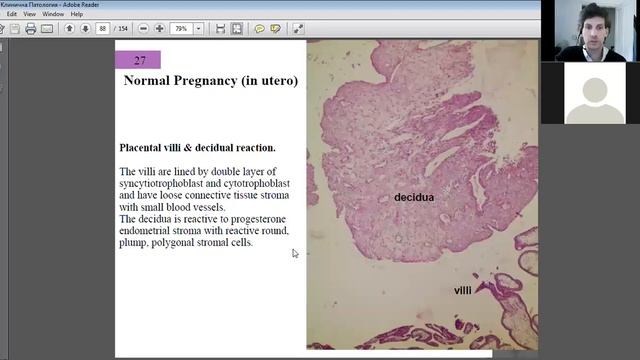 Histo-pathology analysis Part 3 смотреть онлайн