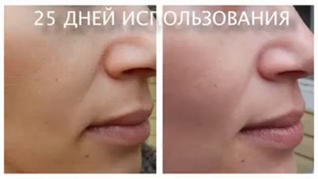ТАКОЙ РЕЗУЛЬТАТ ЗАХОЧЕТ КАЖДЫЙ, ИЛИ КАК ОСТАВИТЬ БЕЗ РАБОТЫ КОСМЕТОЛОГОВ смотреть онлайн