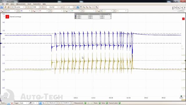 Pierde Fuerza ¿Diagnóstico Mal Hecho?