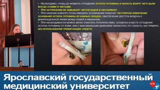 Сухое ведение пуповины. Цыплина О.А. смотреть онлайн