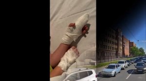 Ребенок пять часов ждал помощи: Четырехлетнему мальчику оторвало палец на карусели в детском саду