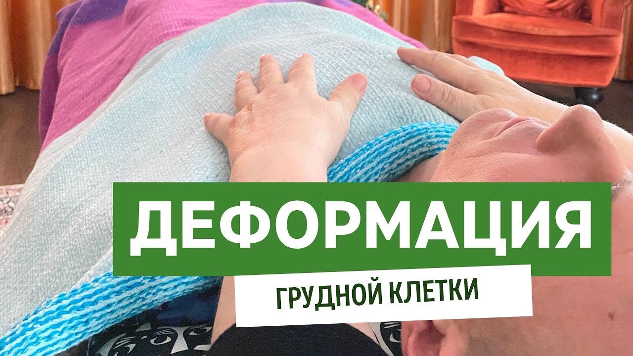 Деформация грудной клетки - последствия посещения стоматолога. смотреть онлайн